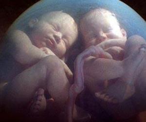 LIFE AFTER BIRTH